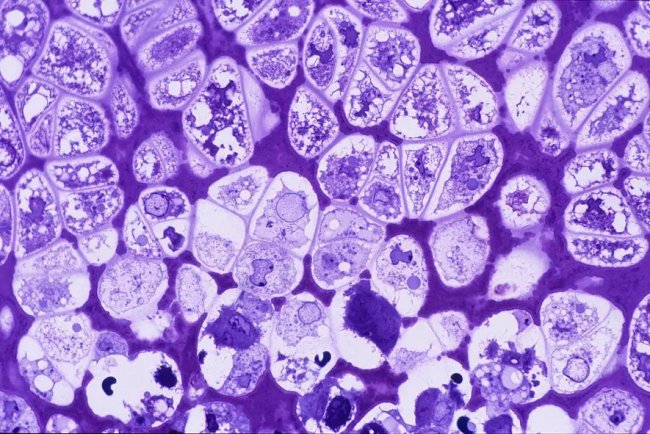 What are Chondrocytes? UPSC Notes